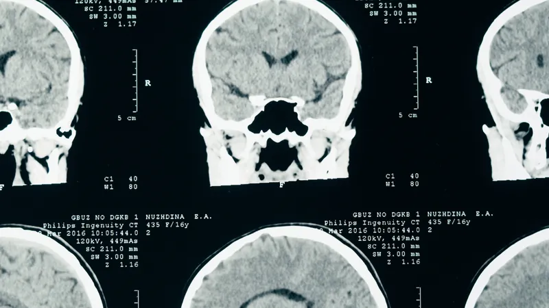 an MRI scan of a human brain